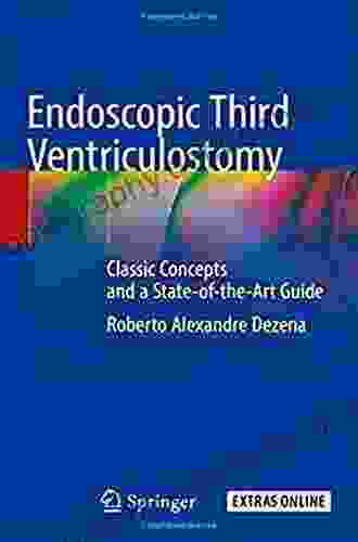 Endoscopic Third Ventriculostomy: Classic Concepts And A State Of The Art Guide