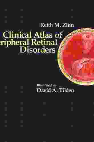 Clinical Atlas Of Peripheral Retinal Disorders